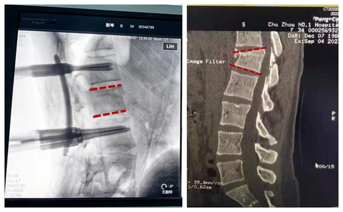 �?  ǰ׵߶ȼ͹ԱȣЧ_.jpg